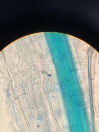 Figure 12: Hyphes intra-radiculaire et vésicule/spore (?) mycorhiziens dans le cortex racinaire d'un plan de blé de 61 jours.