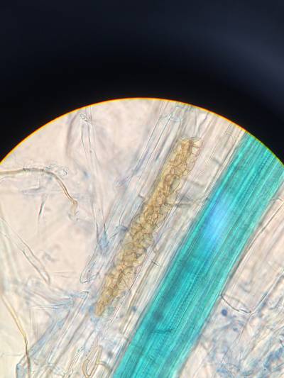 Figure 11: Vésicule(?) mycorhizienne dans le cortex racinaire d'un plan de blé de 61 jours jours.